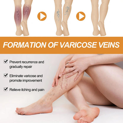 🌿 Varicose Vein Relief Spray – Soothing Comfort in Every Spray! 💧