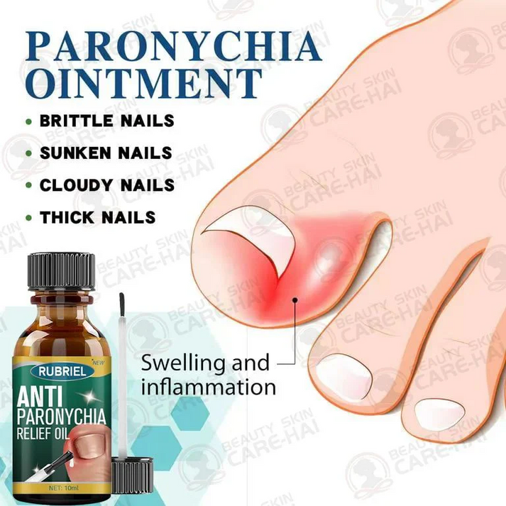 Anti Paronychia Relief Oil 🌿 - (Buy 1 Get 1 FREE🔥🔥)