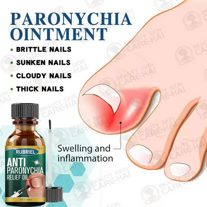 Anti Paronychia Relief Oil 🌿 - (Buy 1 Get 1 FREE🔥🔥)
