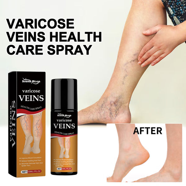 🌿 Varicose Vein Relief Spray – Soothing Comfort in Every Spray! 💧