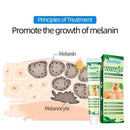 Sumifun Vitiligo Treatment Cream (BUY 1 GET 1 FREE)