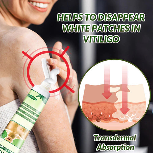Sumifun Vitiligo Treatment Cream (BUY 1 GET 1 FREE)