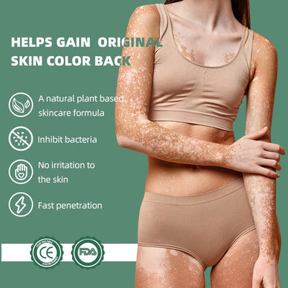 Sumifun Vitiligo Treatment Cream (BUY 1 GET 1 FREE)